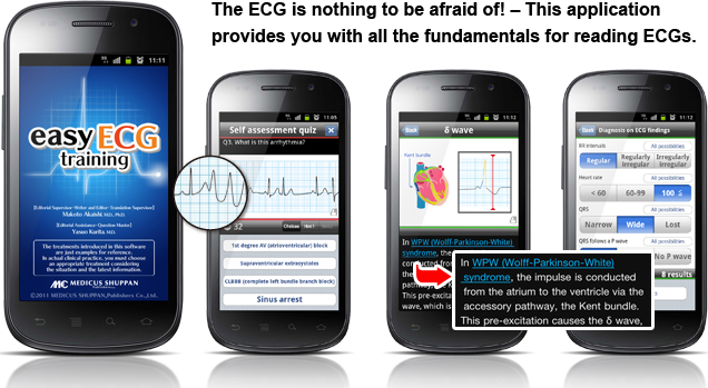 The ECG is nothing to be afraid of! – This application provides you with all fundamentals for reading ECGs. 