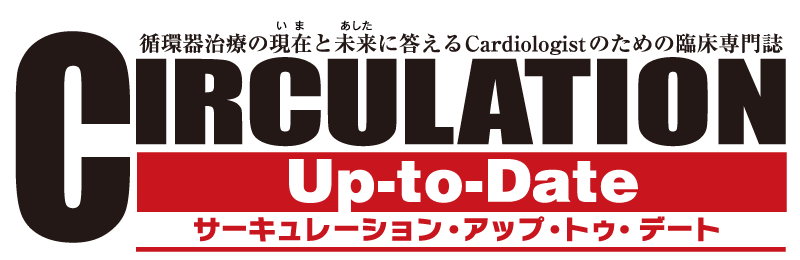 サーキュレーション・アップ・トゥ・デート / CIRCULATION Up-to-Date