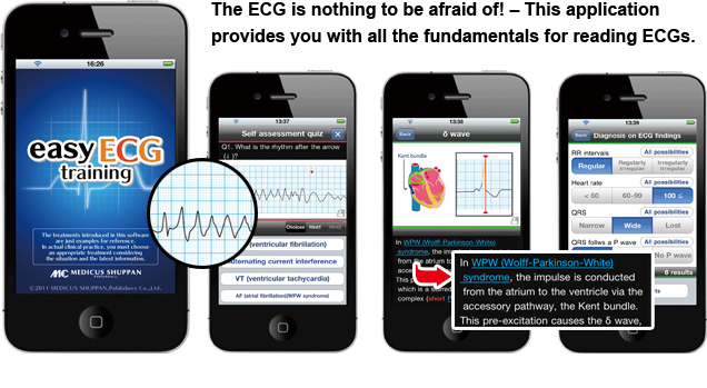 The ECG is nothing to be afraid of! – This application provides you with all fundamentals for reading ECGs. 